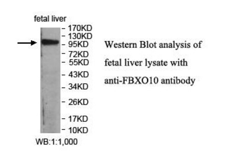 FBXO10 Antibody from Signalway Antibody (39860) - Antibodies.com