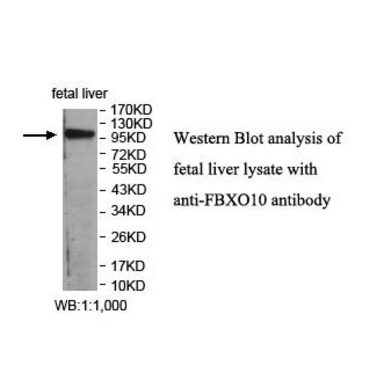 FBXO10 Antibody from Signalway Antibody (39860) - Antibodies.com