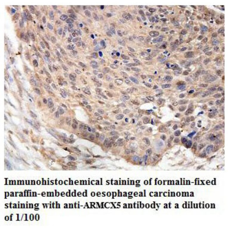 ARMCX5 Antibody from Signalway Antibody (39862) - Antibodies.com
