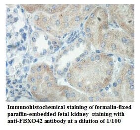 FBXO42 Antibody from Signalway Antibody (39863) - Antibodies.com