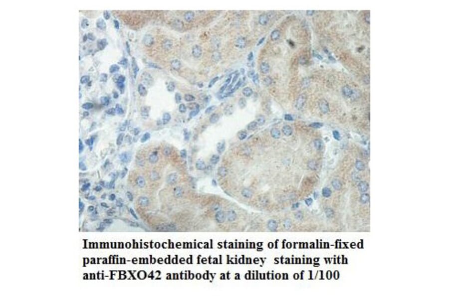 FBXO42 Antibody from Signalway Antibody (39863) - Antibodies.com