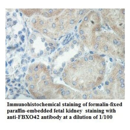 FBXO42 Antibody from Signalway Antibody (39863) - Antibodies.com