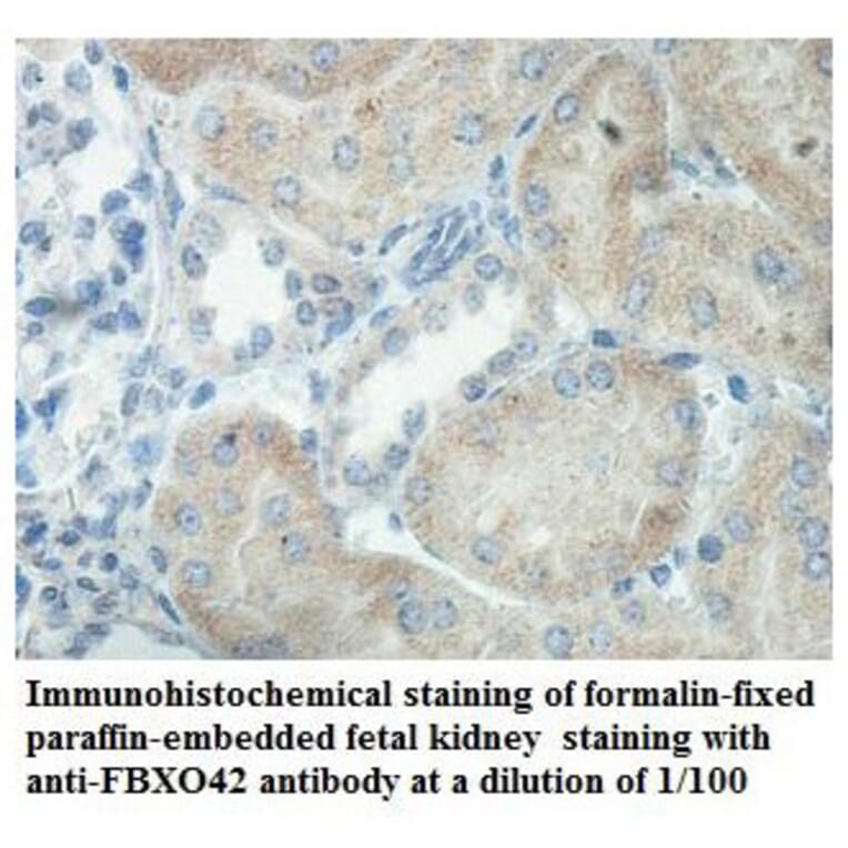 FBXO42 Antibody from Signalway Antibody (39863) - Antibodies.com