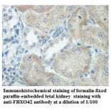 FBXO42 Antibody from Signalway Antibody (39863) - Antibodies.com