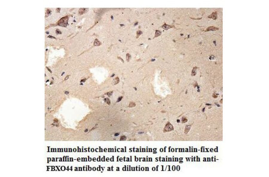 FBXO44 Antibody from Signalway Antibody (39864) - Antibodies.com