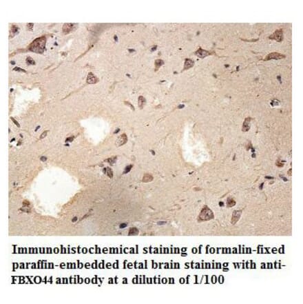 FBXO44 Antibody from Signalway Antibody (39864) - Antibodies.com