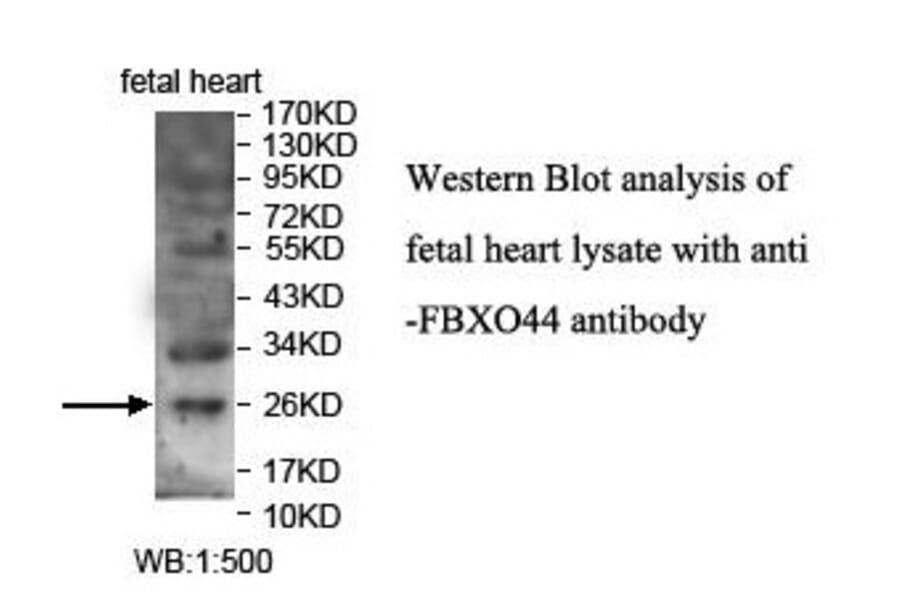 FBXO44 Antibody from Signalway Antibody (39864) - Antibodies.com