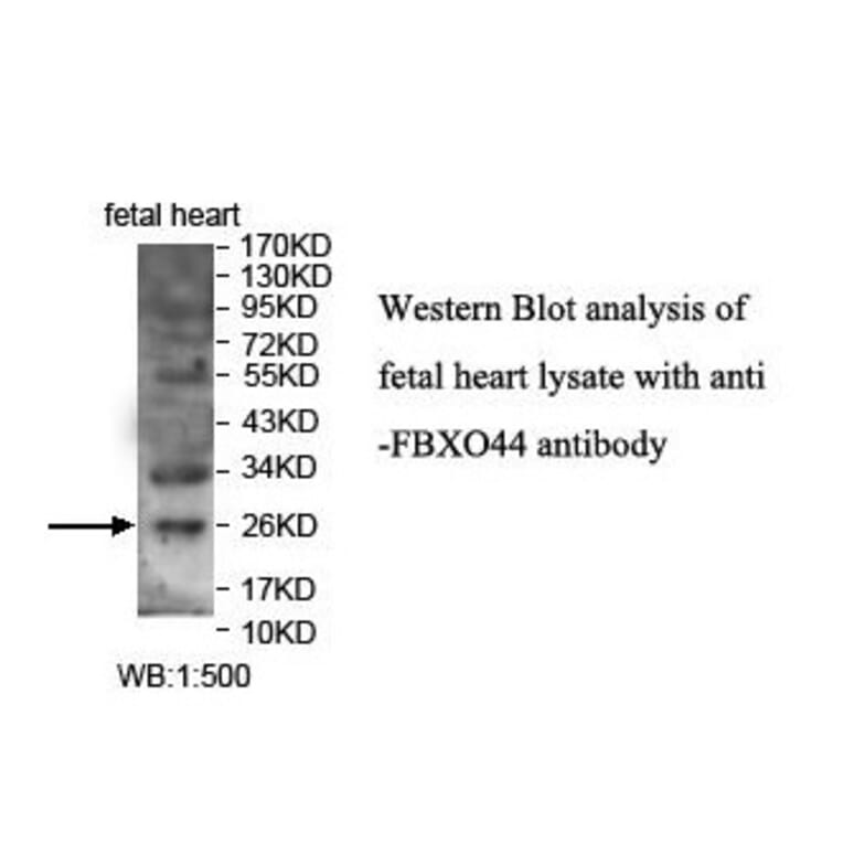 FBXO44 Antibody from Signalway Antibody (39864) - Antibodies.com