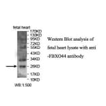 FBXO44 Antibody from Signalway Antibody (39864) - Antibodies.com