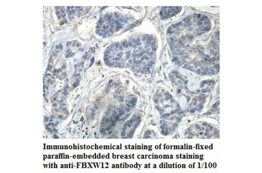 FBXW12 Antibody from Signalway Antibody (39865) - Antibodies.com