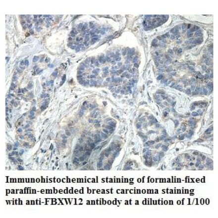 FBXW12 Antibody from Signalway Antibody (39865) - Antibodies.com