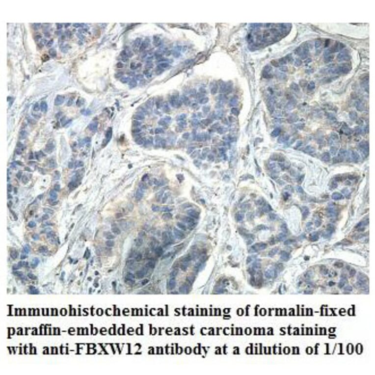 FBXW12 Antibody from Signalway Antibody (39865) - Antibodies.com