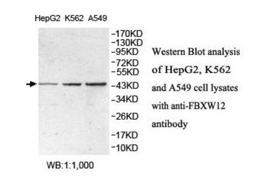 FBXW12 Antibody from Signalway Antibody (39865) - Antibodies.com