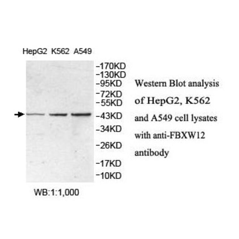 FBXW12 Antibody from Signalway Antibody (39865) - Antibodies.com