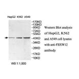 FBXW12 Antibody from Signalway Antibody (39865) - Antibodies.com