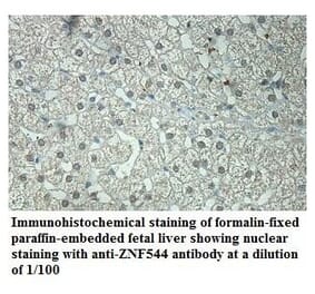 ZNF544 Antibody from Signalway Antibody (39869) - Antibodies.com