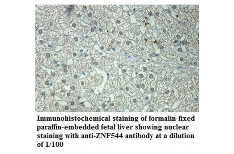 ZNF544 Antibody from Signalway Antibody (39869) - Antibodies.com