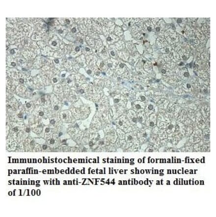 ZNF544 Antibody from Signalway Antibody (39869) - Antibodies.com