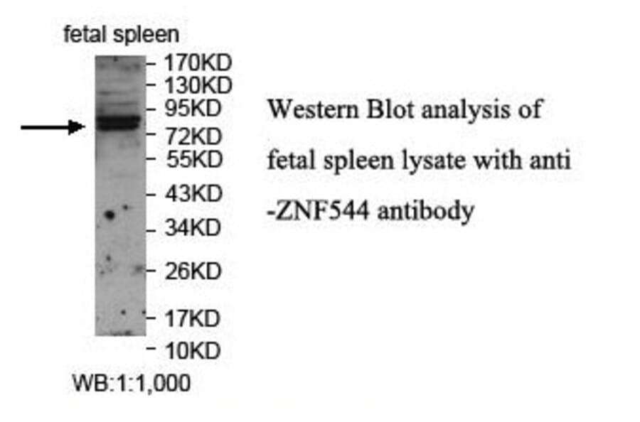 ZNF544 Antibody from Signalway Antibody (39869) - Antibodies.com