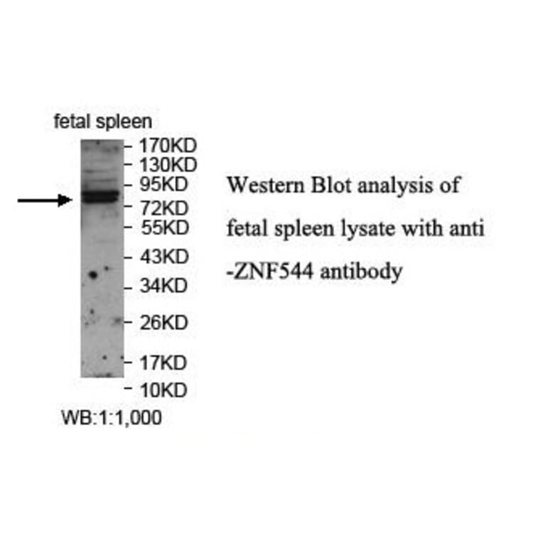 ZNF544 Antibody from Signalway Antibody (39869) - Antibodies.com