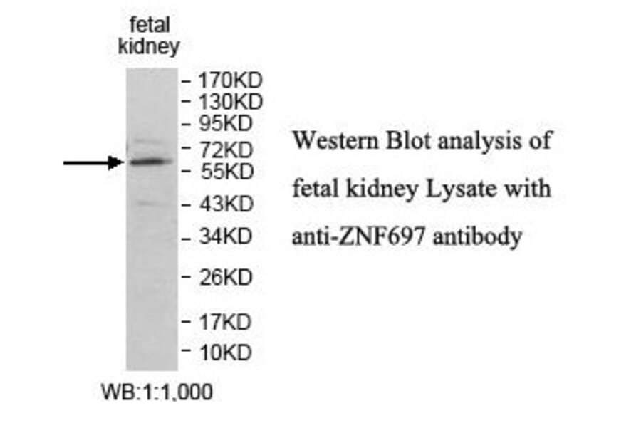 ZNF697 Antibody from Signalway Antibody (39870) - Antibodies.com