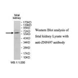 ZNF697 Antibody from Signalway Antibody (39870) - Antibodies.com