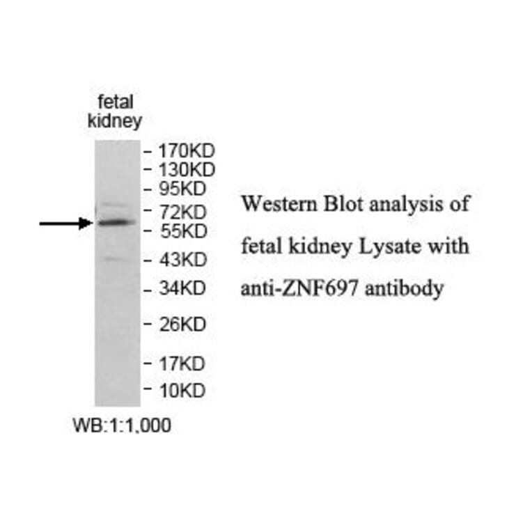 ZNF697 Antibody from Signalway Antibody (39870) - Antibodies.com
