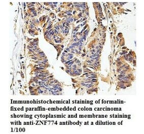 ZNF774 Antibody from Signalway Antibody (39871) - Antibodies.com