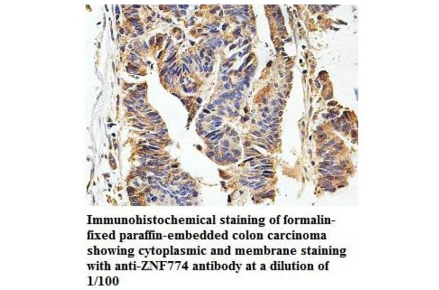 ZNF774 Antibody from Signalway Antibody (39871) - Antibodies.com