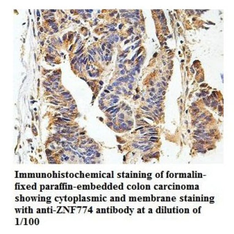 ZNF774 Antibody from Signalway Antibody (39871) - Antibodies.com