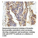ZNF774 Antibody from Signalway Antibody (39871) - Antibodies.com