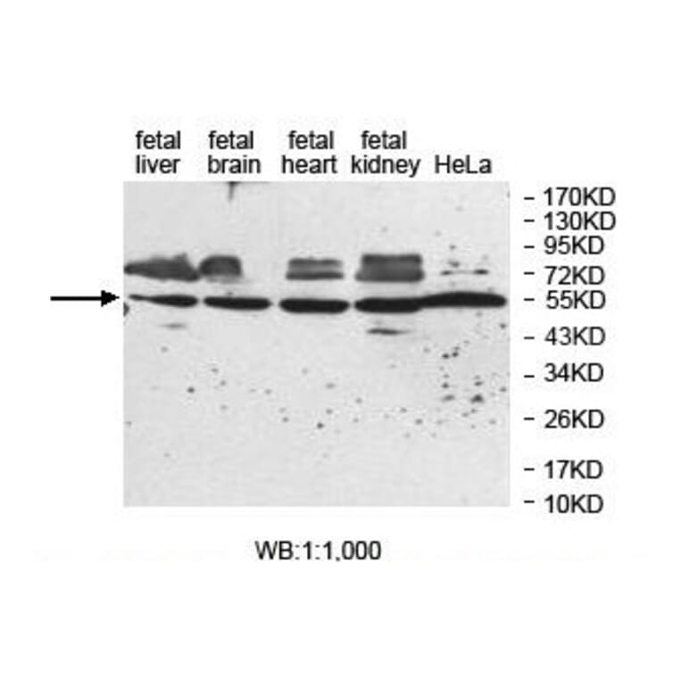 ZNF774 Antibody from Signalway Antibody (39871) - Antibodies.com