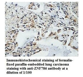 ZNF786 Antibody from Signalway Antibody (39872) - Antibodies.com