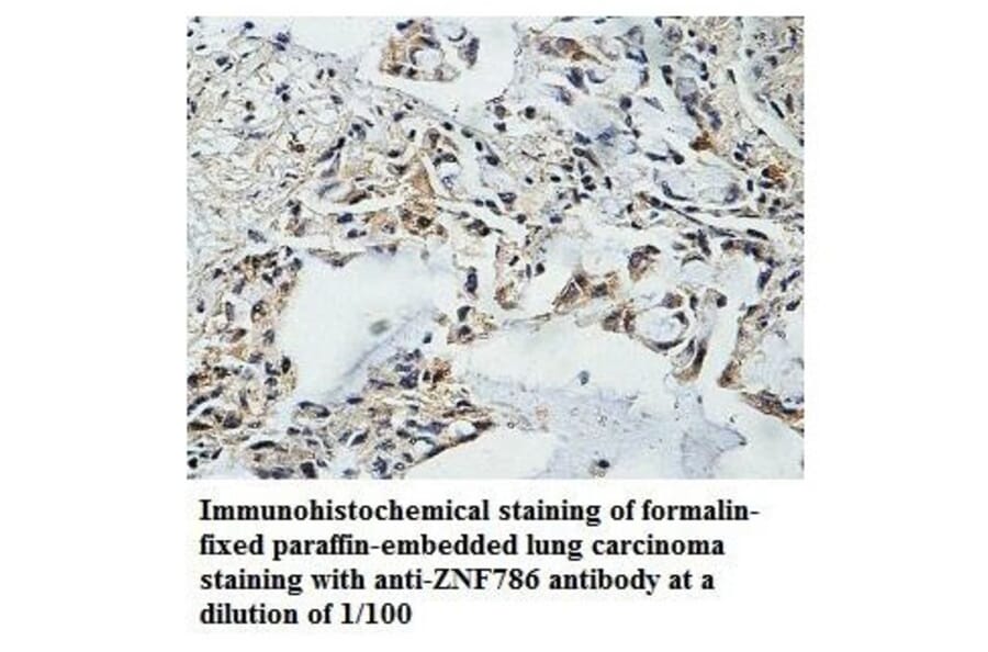 ZNF786 Antibody from Signalway Antibody (39872) - Antibodies.com