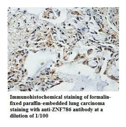 ZNF786 Antibody from Signalway Antibody (39872) - Antibodies.com