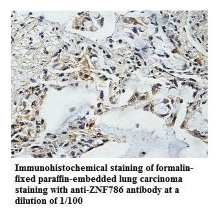 ZNF786 Antibody from Signalway Antibody (39872) - Antibodies.com