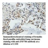 ZNF786 Antibody from Signalway Antibody (39872) - Antibodies.com