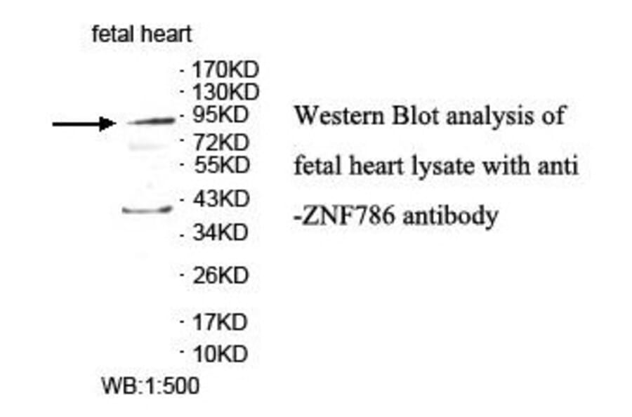 ZNF786 Antibody from Signalway Antibody (39872) - Antibodies.com