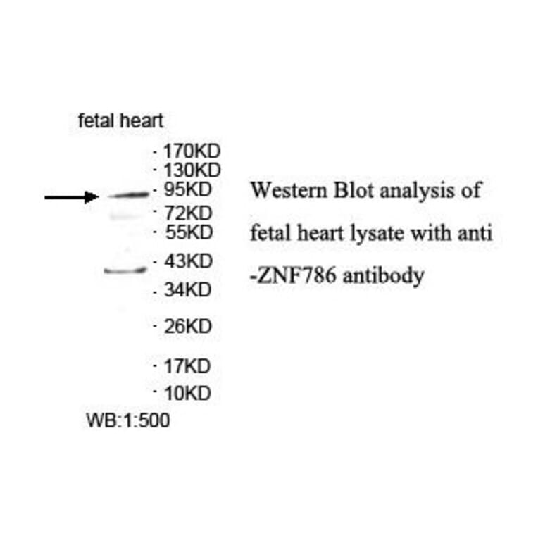 ZNF786 Antibody from Signalway Antibody (39872) - Antibodies.com