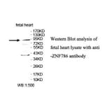 ZNF786 Antibody from Signalway Antibody (39872) - Antibodies.com