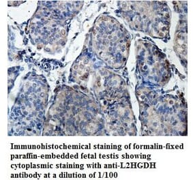 L2HGDH Antibody from Signalway Antibody (39874) - Antibodies.com
