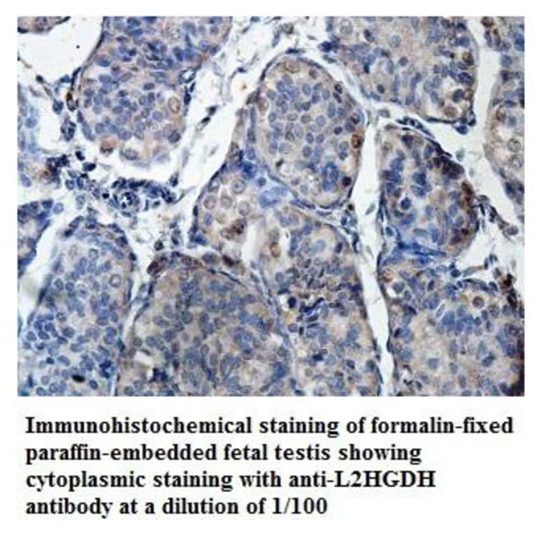 L2HGDH Antibody from Signalway Antibody (39874) - Antibodies.com