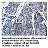 L2HGDH Antibody from Signalway Antibody (39874) - Antibodies.com