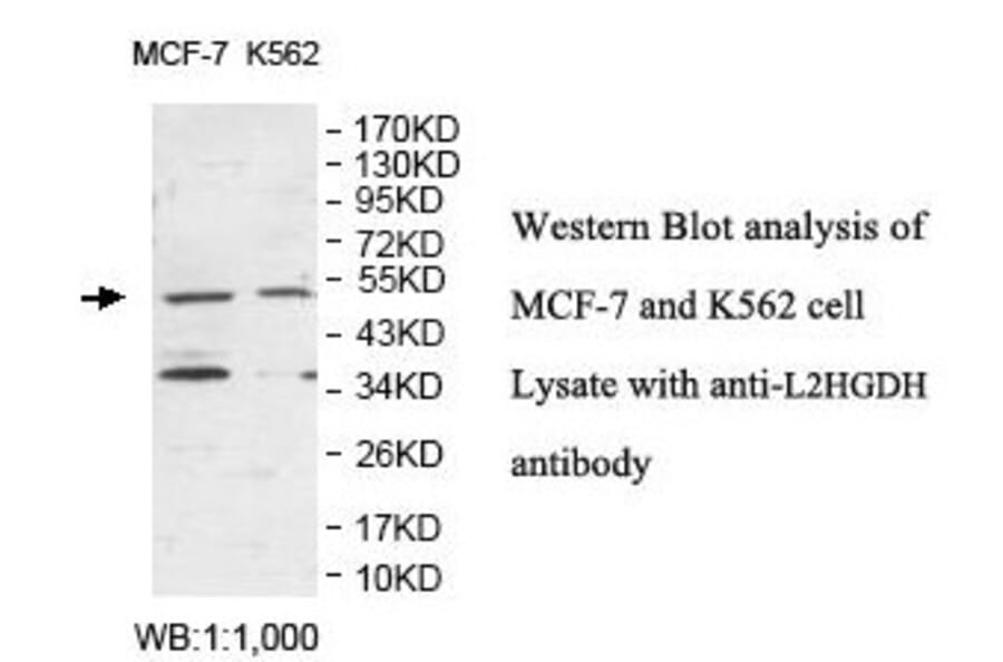 L2HGDH Antibody from Signalway Antibody (39874) - Antibodies.com