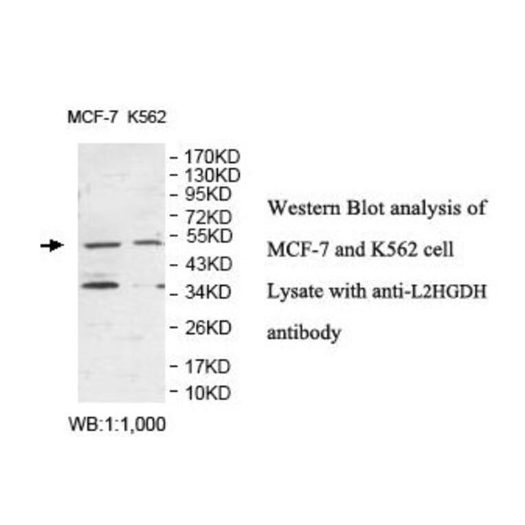 L2HGDH Antibody from Signalway Antibody (39874) - Antibodies.com