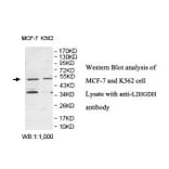 L2HGDH Antibody from Signalway Antibody (39874) - Antibodies.com