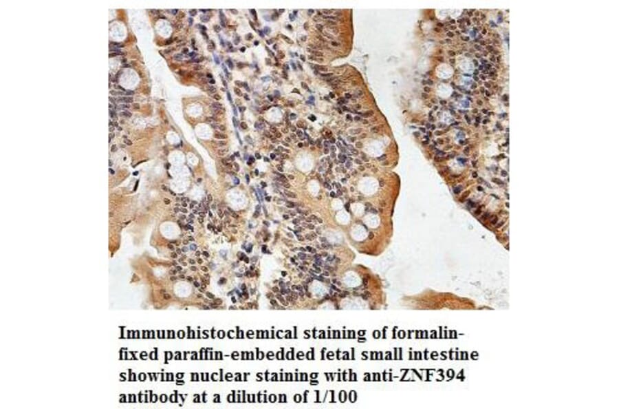 ZNF394 Antibody from Signalway Antibody (39877) - Antibodies.com
