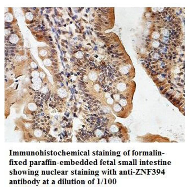 ZNF394 Antibody from Signalway Antibody (39877) - Antibodies.com