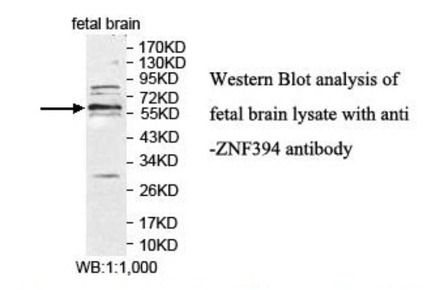 ZNF394 Antibody from Signalway Antibody (39877) - Antibodies.com