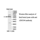 ZNF394 Antibody from Signalway Antibody (39877) - Antibodies.com